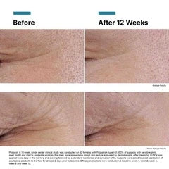 Skinceuticals P-TIOX